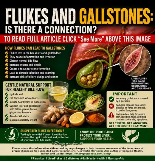 FLUKES AND GALLSTONES: IS THERE A CONNECTION?
