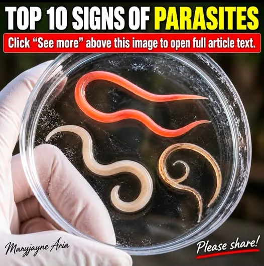 TOP 10 SIGNS OF PARASITES.