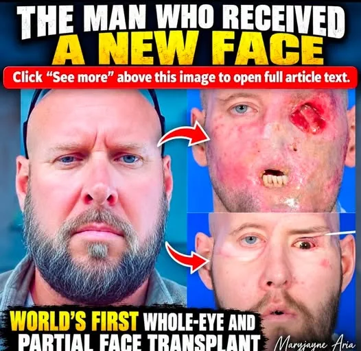 THE MAN WHO RECEIVED A NEW FACE: THE MEDICAL ADVANCE I STILL DON'T KNOW HOW TO FEEL ABOUT
